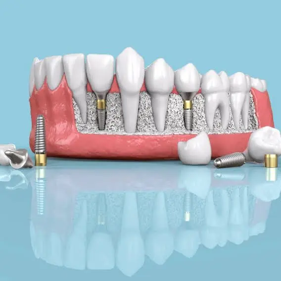 Oasis Dental Care [Invisalign_Braces_Dental Implant & Root Canal Treatment Centre]
